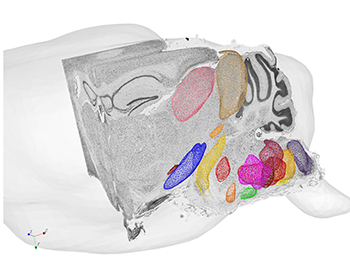 Anatomically defined regions in the brainstem that control orofacial motor actions, superimposed on stained brain tissue. Analysis by Yuncong Chen and Lauren McElvain in the Yoav Freund and David Kleinfeld Laboratories (UC San Diego)